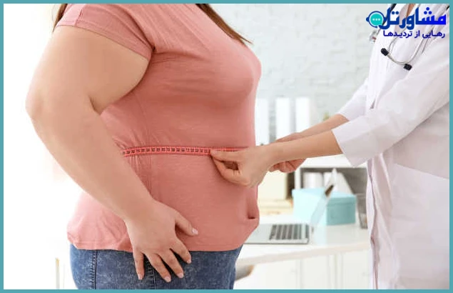 افزایش یا کاهش وزن غیرعادی