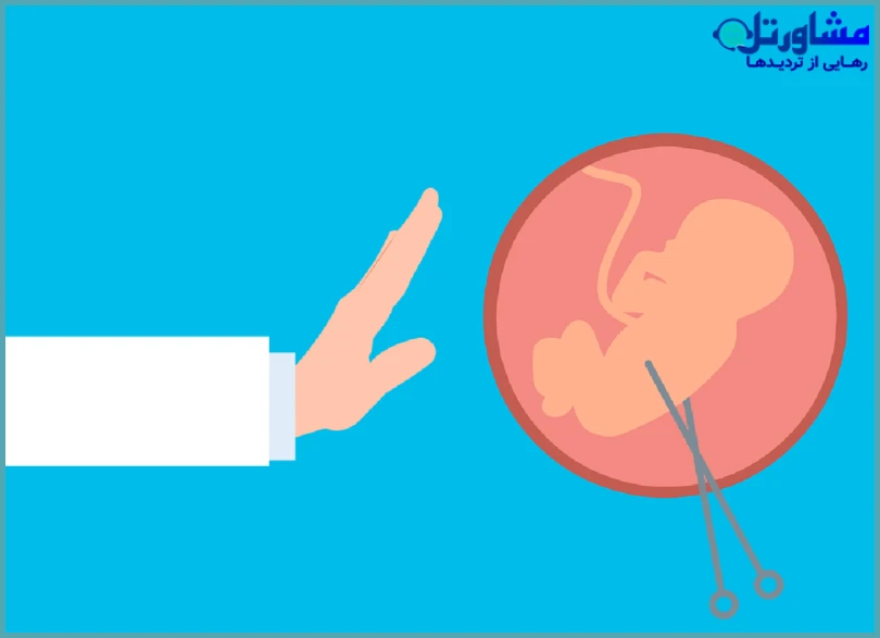 سقط جنین بعد از ۴۰ روزگی (روح وارد شده)